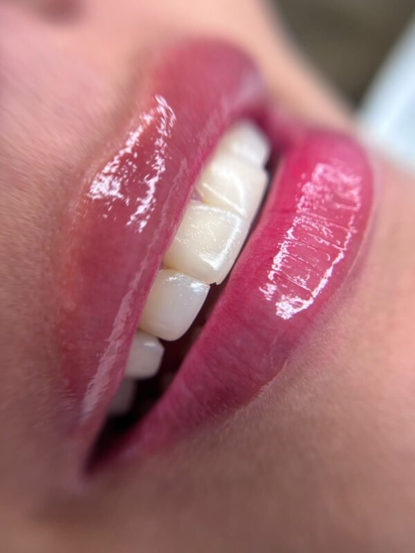 Hidraglow Lips 30 ML - Image 3