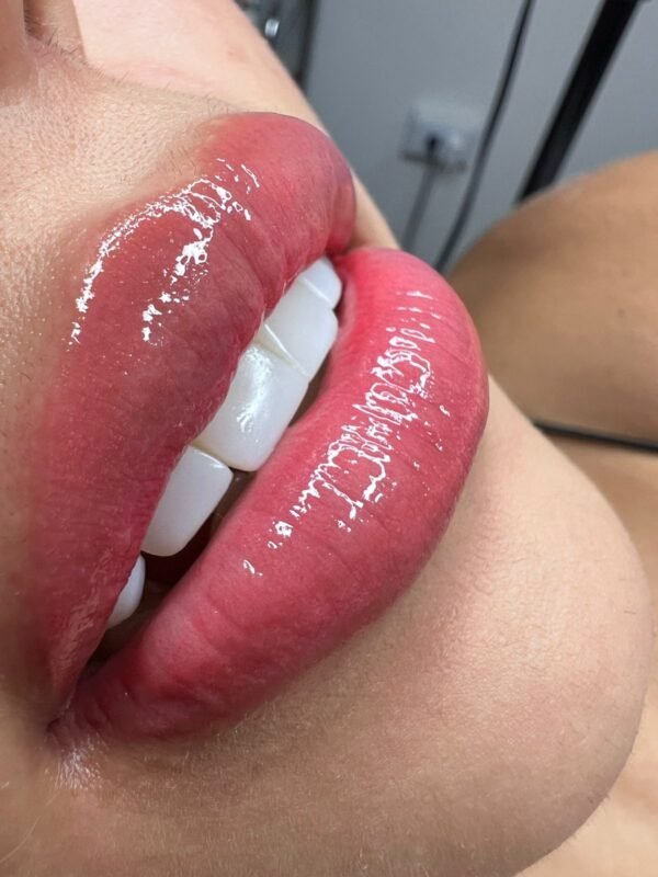 Hidraglow Lips 30 ML - Image 2